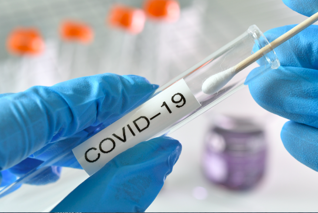 Testing swab being inserted test tube labeled Covid-19. (Photo by: Marg Johnson | twenty20.com)