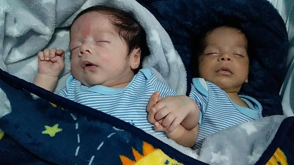 The case of twins Ever Arturo (left) and Luis Fernando (right), who have different skin tone, a rare phenomenon. (Courtesy of Arturo Vázquez)