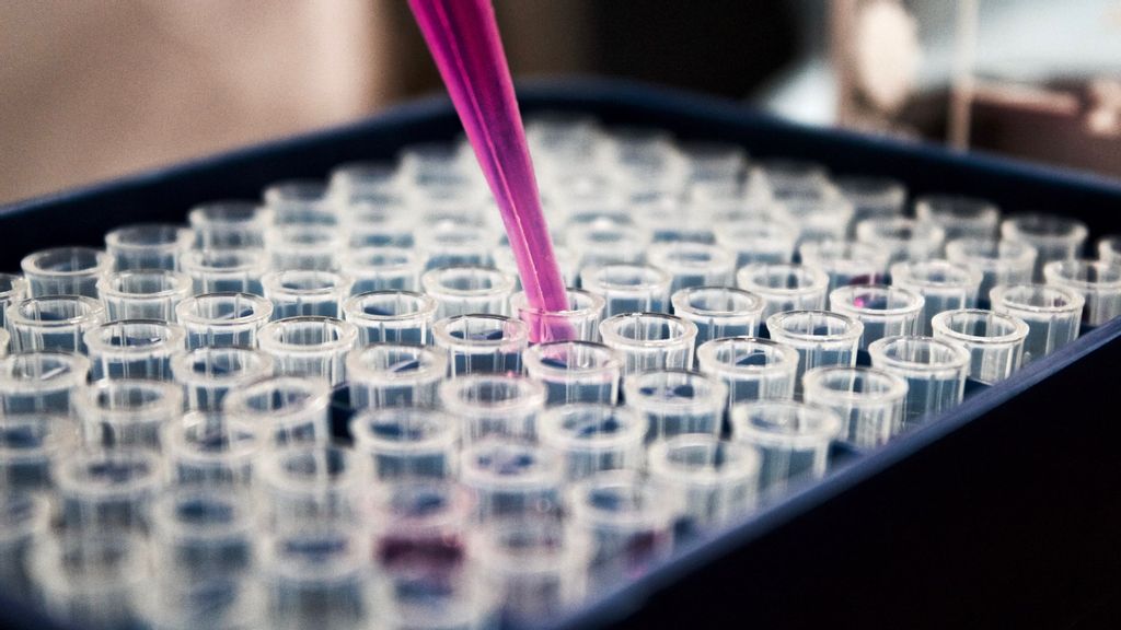 The scientists identified a hotspot neoantigen derived from an oncogene known as RAS, which is involved in a third of all human cancers and 20 percent of melanoma cases. (Louis Reed/Unsplash)